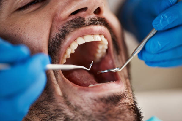 Best Emergency Tooth Extraction in Laymantown, VA