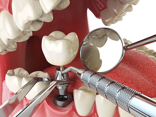 Best Emergency Orthodontic Repairs in Laymantown, VA